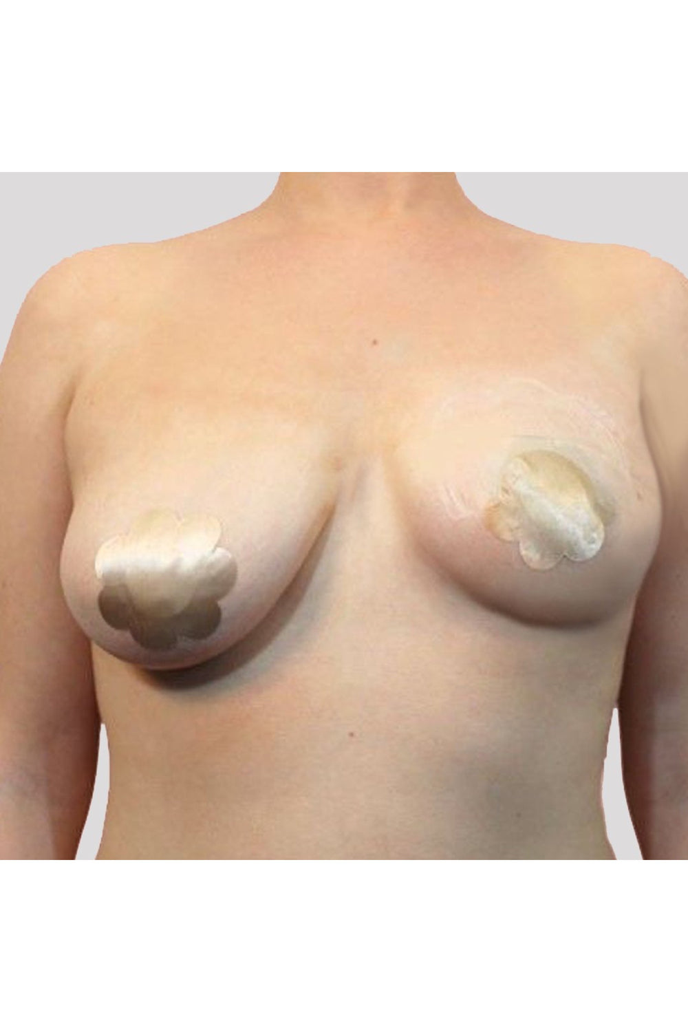 Instant Breast Lifts
